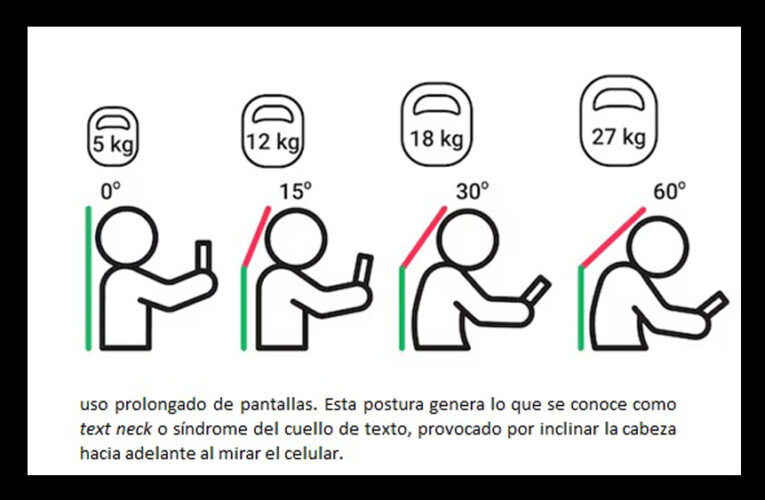 Fuerte impacto de las posturas de niños en edad escolar en afecciones de columna